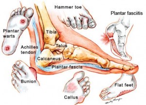 Painful Feet - Find Out Why?
