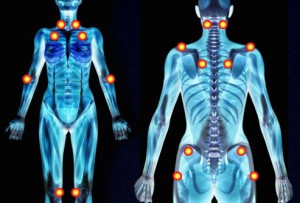 Treatment Options for Fibromyalgia