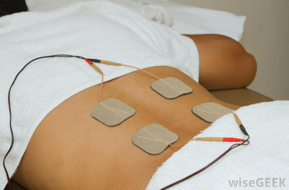 TENS stands for Transcutaneous Electrical Nerve Stimulation. A TENS 