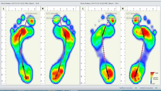 Custom Foot Orthotics - Diversified Health Clinic