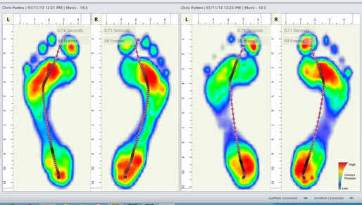 How Orthotics are Made