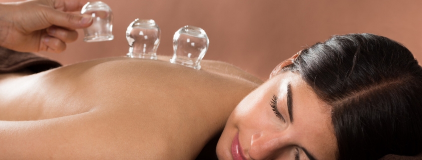 Cupping Origins and Benefits