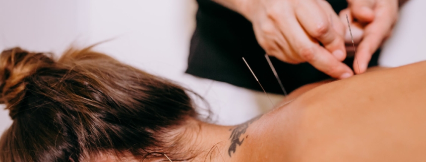 Acupuncture for Immunity