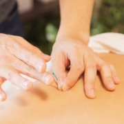 Acupuncture Allergy Treatments: Natural Relief From Achoos! 