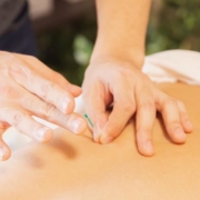 The Ins and Outs of Acupuncture