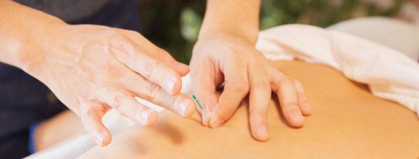 The Ins and Outs of Acupuncture