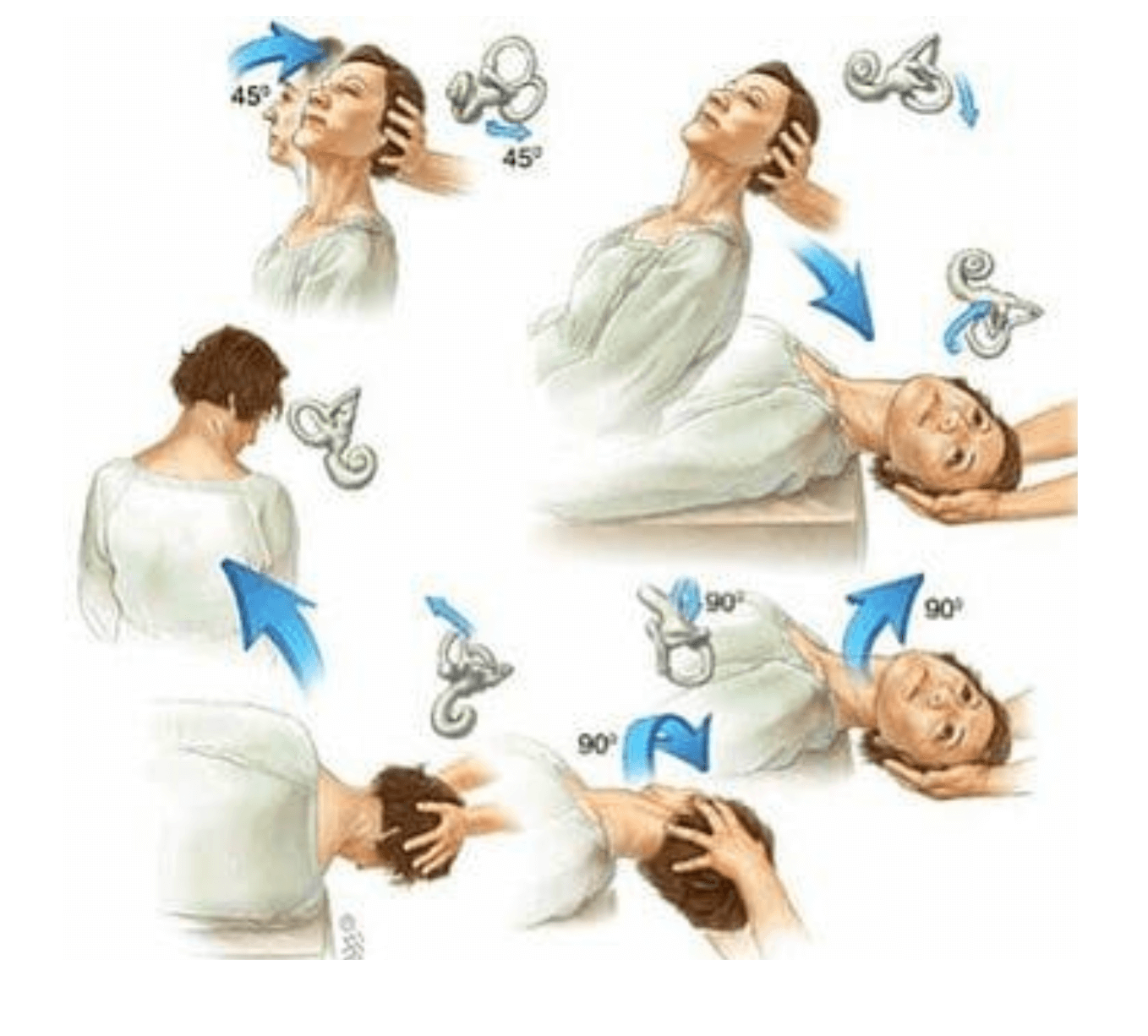 Vertigo, BPPV and the Vestibular System Diversified Health Clinic