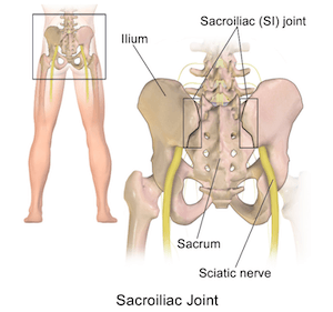 SI Joint Dysfunction