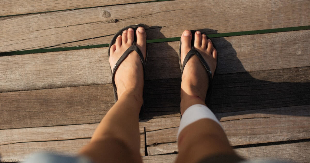 Frustrated with Flip Flop Friction? - The Nail Lady