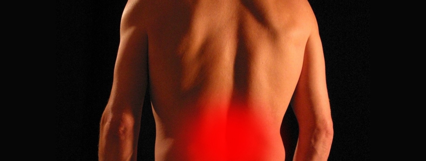 Man's lower back with the painful area highlighted in red